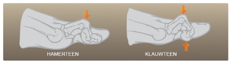 Picture 1